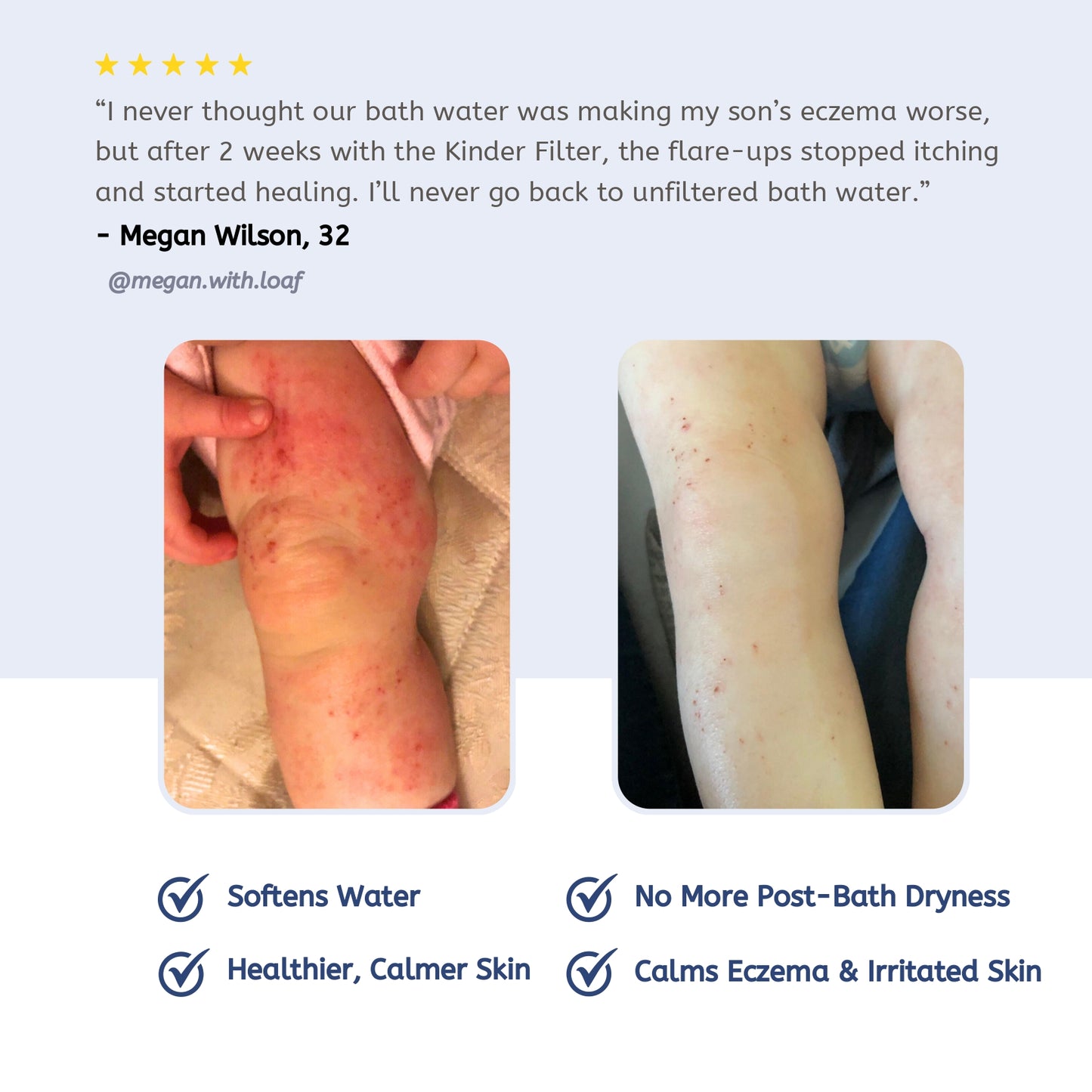 Skincare Bath Filter by Kinder Filter