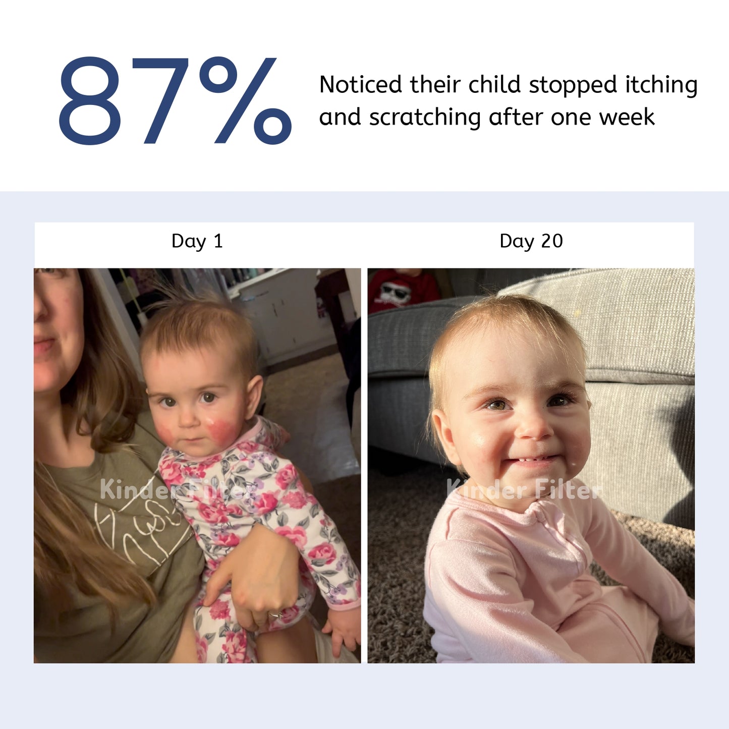 Skincare Bath Filter by Kinder Filter