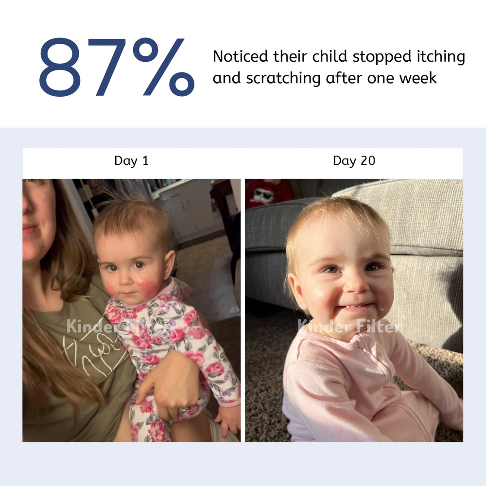 87% noticed their child stopped itching and scratching after one week: Day 1 and Day 20