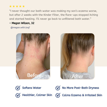 Skincare Bath Filter by Kinder Filter