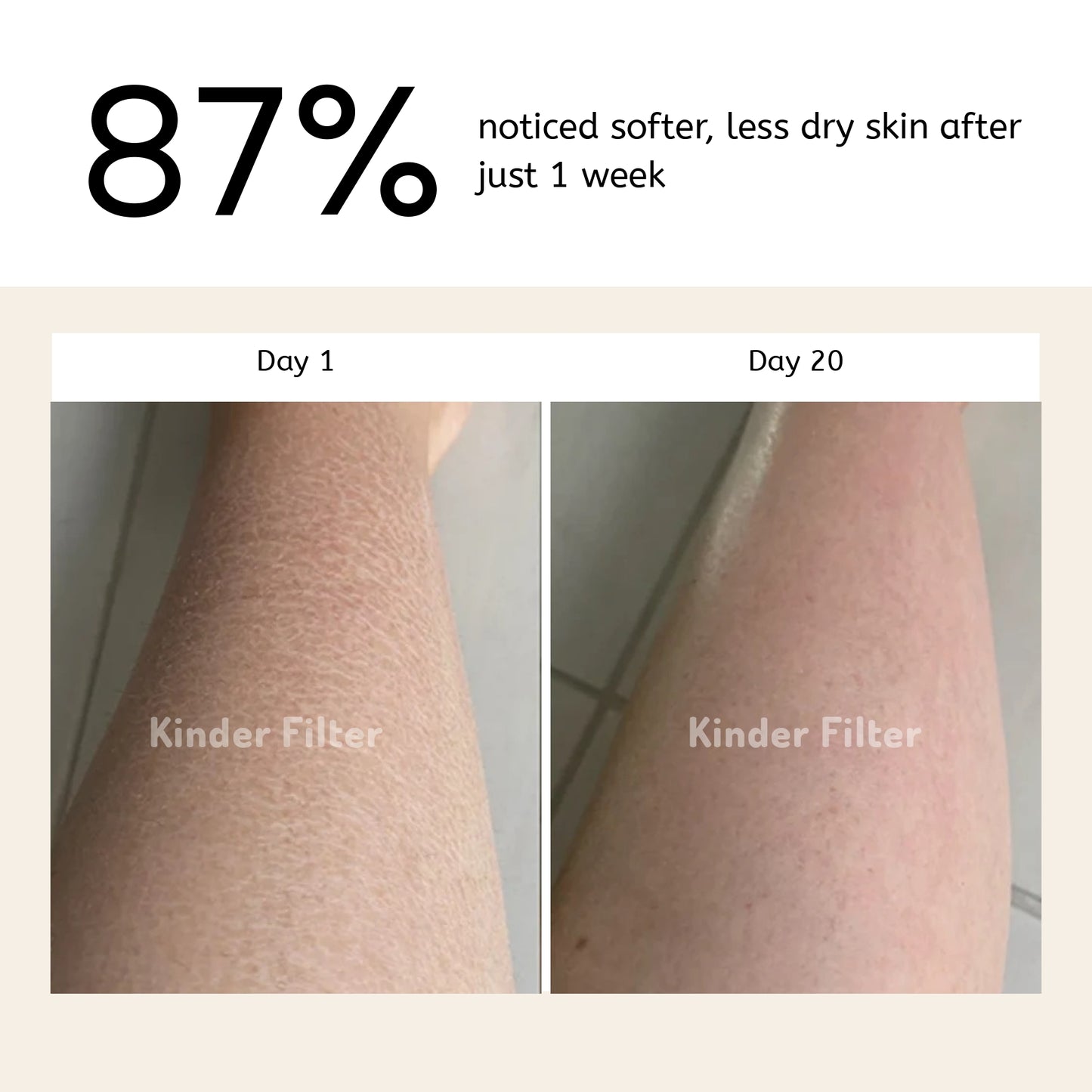 Skincare Bath Filter by Kinder Filter