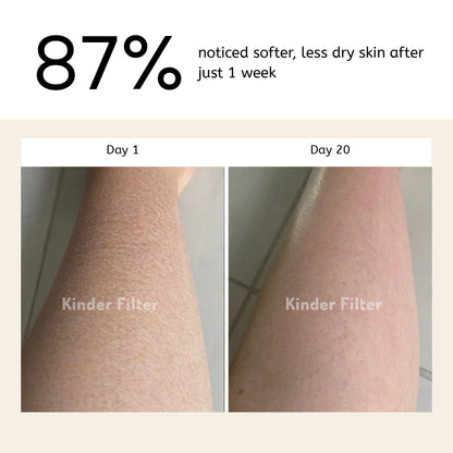 Skincare Bath Filter by Kinder Filter