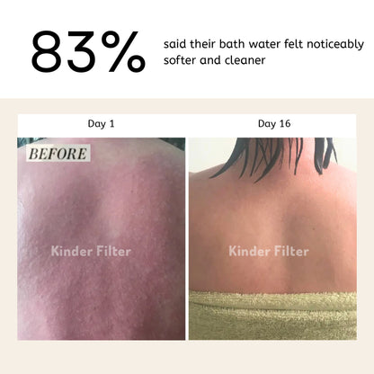 Skincare Bath Filter by Kinder Filter
